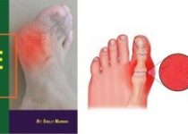 The End Of Gout book cover